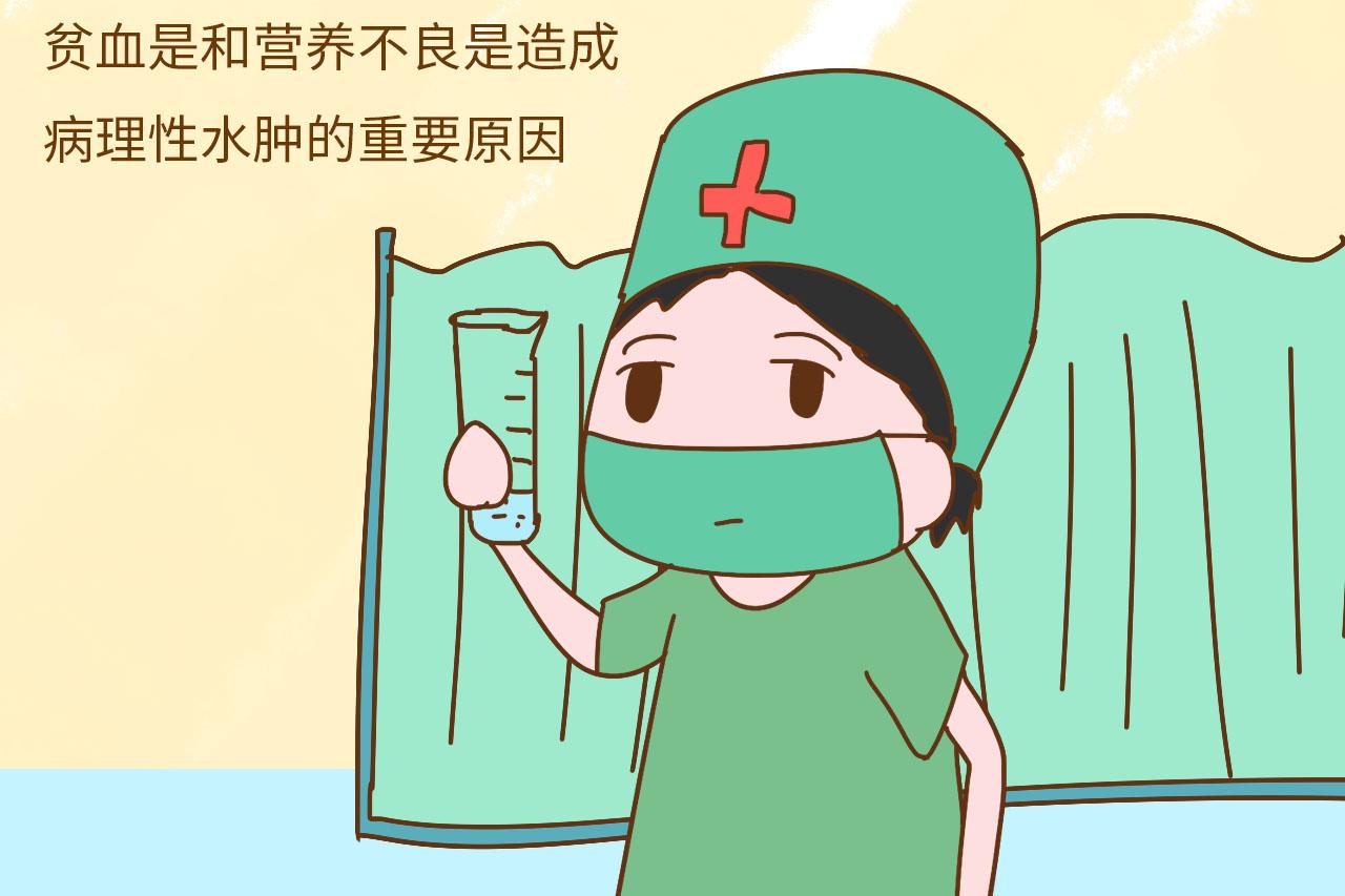 孕期水肿的最厉害的, 就属这位孕妈了, 什么都变大了