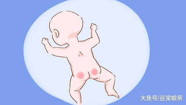 剖腹产生下的宝宝, 容易有这4种后遗症, 孕妈还是尽量顺产吧