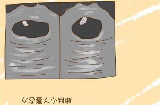 孕囊大小预测生男生女准吗?