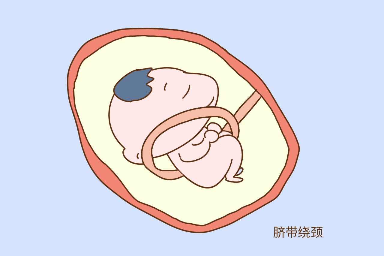 孕晚期需要密切注意的四个字, 事关宝宝能否安全出生, 孕妈别大意