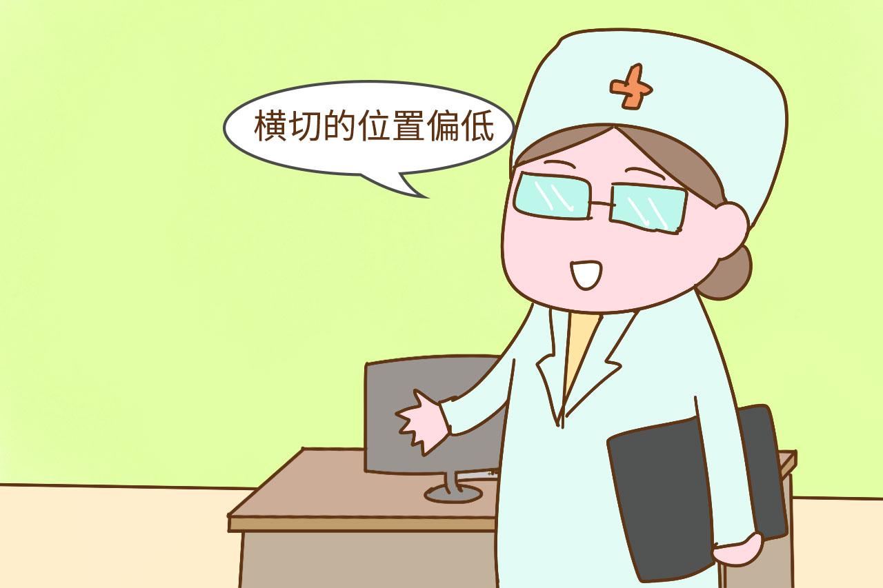 剖腹产刀口是竖切好还是横切好? 别光顾着美, 听听医生怎么说