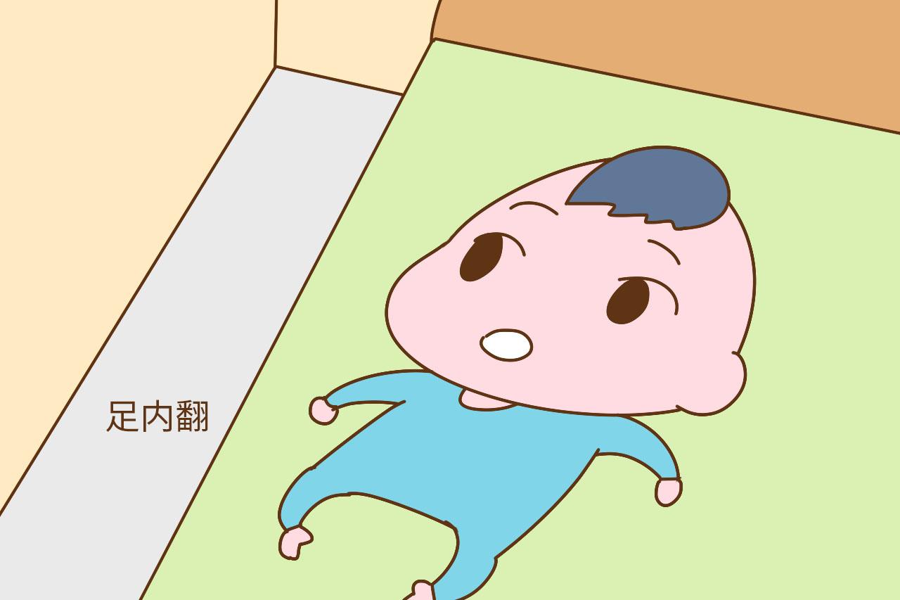 孩子出生后, 脚部呈这个形态, 可能是足内翻, 需要就医了