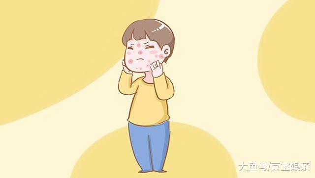 害怕娃将来一脸青春痘? 这些措施从小抓起