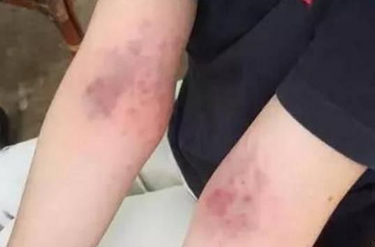 每天拍3处, 拍掉体内湿气, 百病不生, 简单易做! 收藏