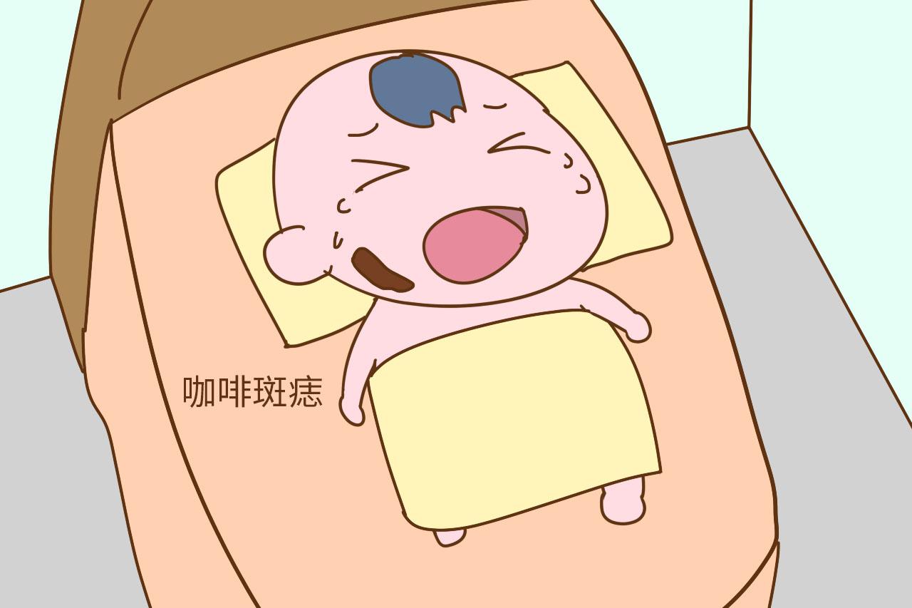 事关宝宝无小事, 这3种胎记就存在健康隐患, 妈妈们别掉以轻心