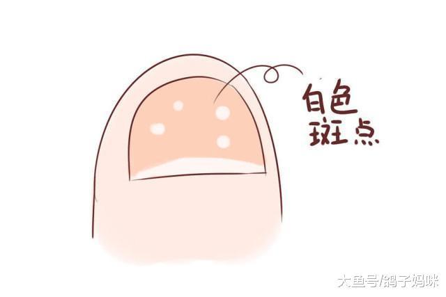 留意宝宝指甲异常, 扼杀疾病萌芽!
