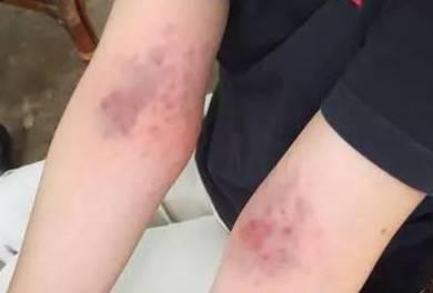 女人身上有3个“排毒窝”, 三伏天拍一拍, 去湿气排毒素, 健康一整年