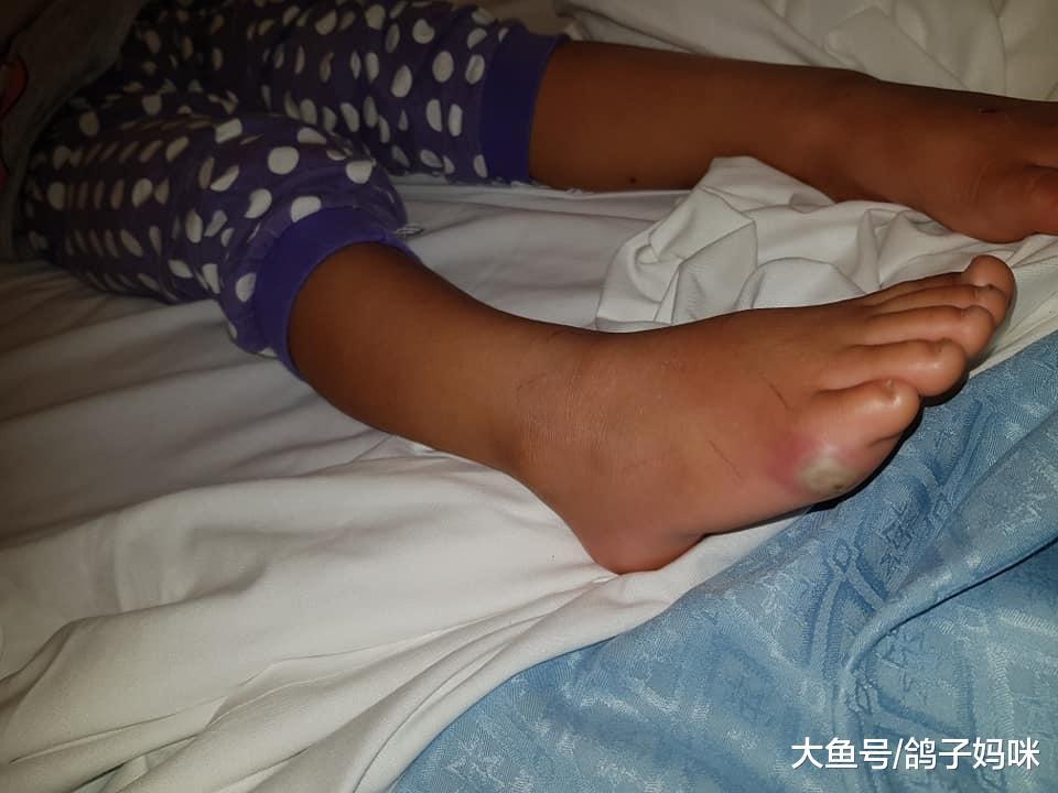 4岁女孩光脚试鞋, 竟染败血症! 带孩子挑鞋这些要注意!