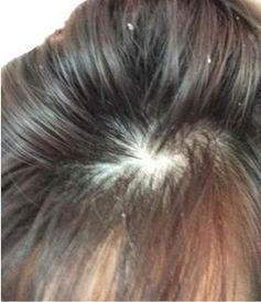 15岁少女身体发异味, 遭人嘲笑砸伤同学, 医生却说: 怪父母太粗心