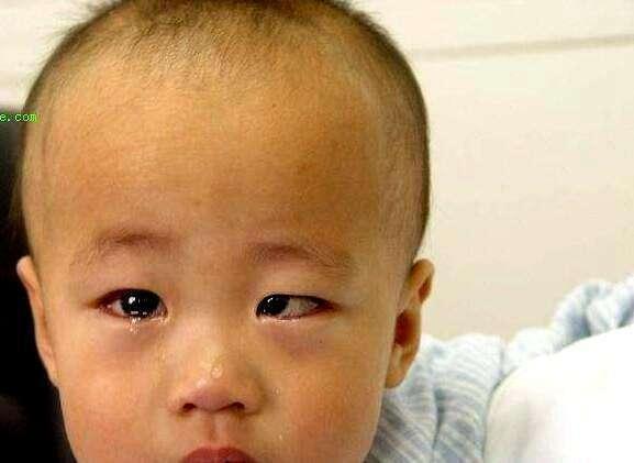 5岁小男孩一觉醒来黑眼珠“失踪”, 医生叹息: 怪父母太无知!