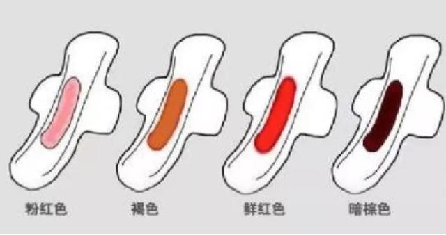 女人大姨妈的颜色是“信号灯”, 决定了你的健康, 别忽略了!