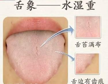 每天拍一拍, 拍掉体内湿气, 百病无, 简单易学!