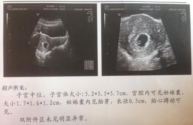 整个孕期做了好几次四维, 那些数据真的可以判断男女吗?
