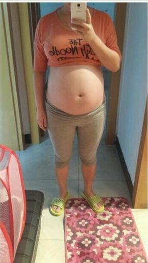 四维大排畸顺利归来, 分享下怀女宝的症状及肚型