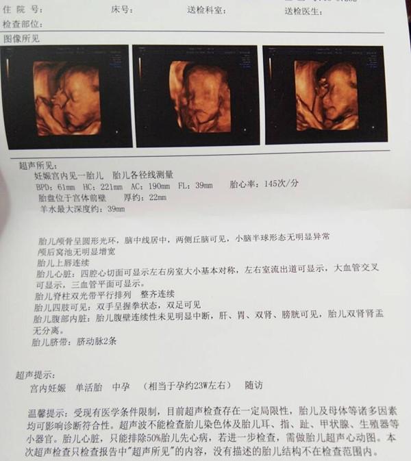 5月21日生啦! 女宝宝一枚, 痛并快乐着!