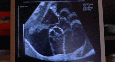 胎动也能看出男女了? 准妈妈您认为靠谱吗?