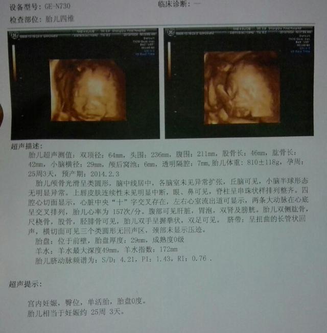 四维归来确认女宝一枚, 现在分享一下怀女宝的症状, 传好孕啦