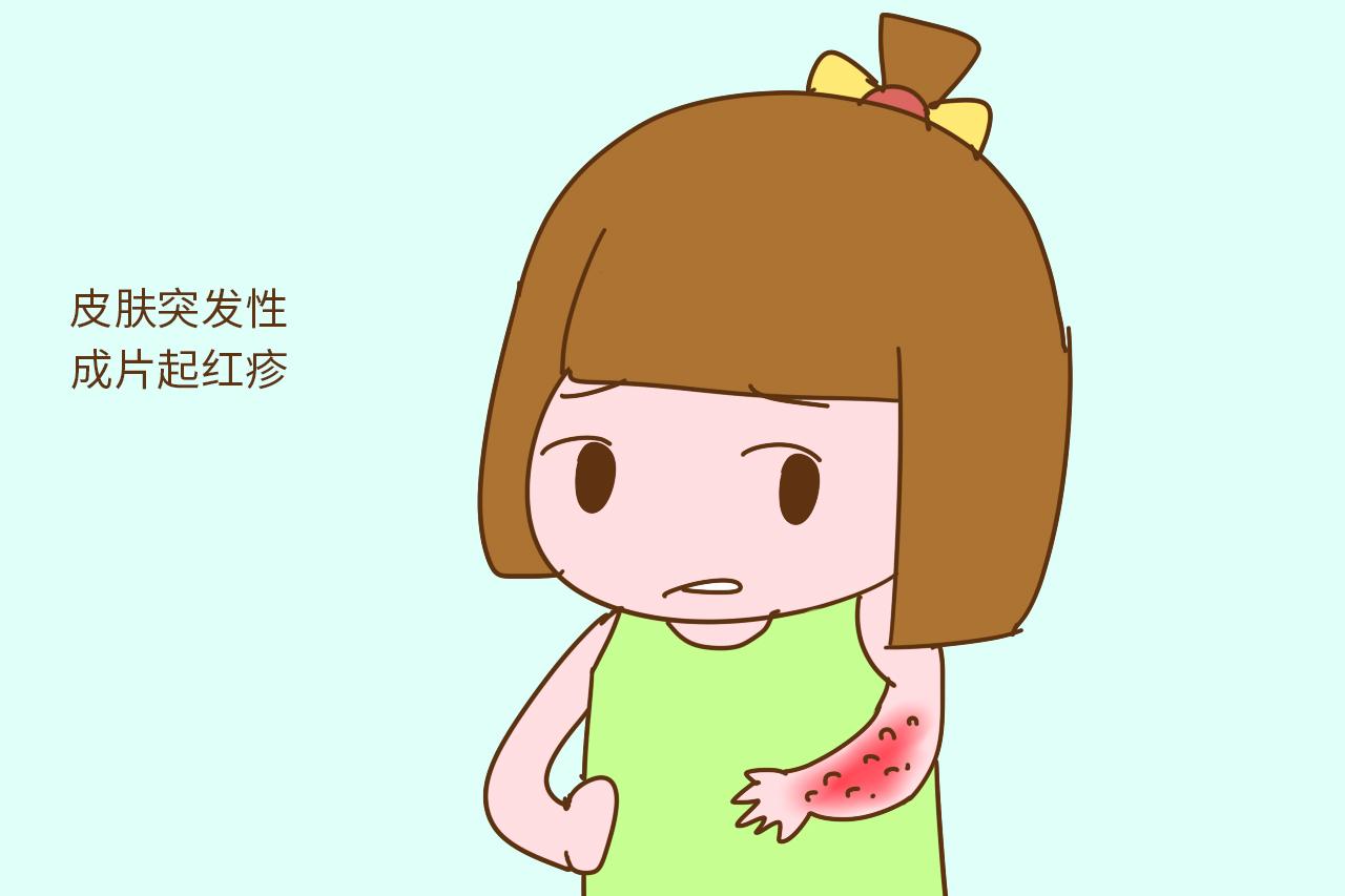 这个季节孩子很容易过敏, 提前做好预防, 让孩子少受罪