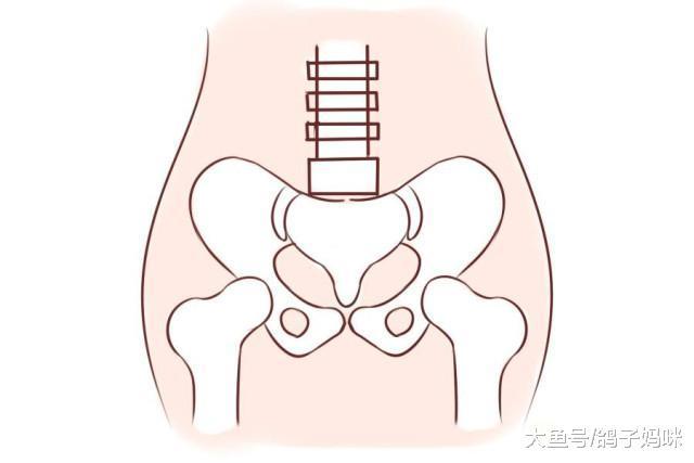 静脉受阻学说,产伤,胸锁乳突肌先天发育不良,骨盆底肌肉和韧带问题等