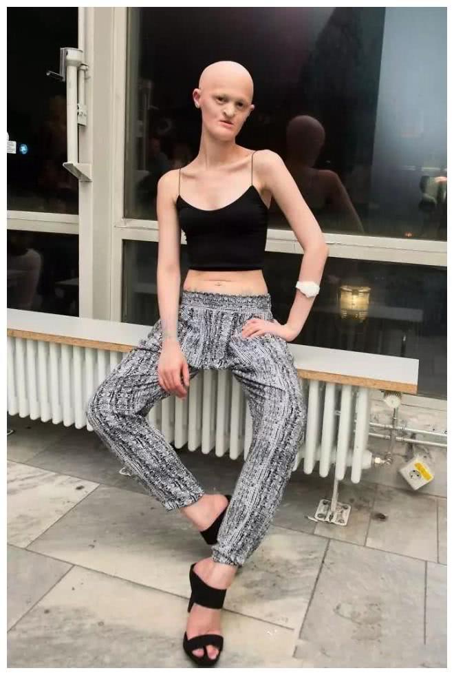 女子长相怪异被朋友称作外星人, 凭这张脸成国际名模