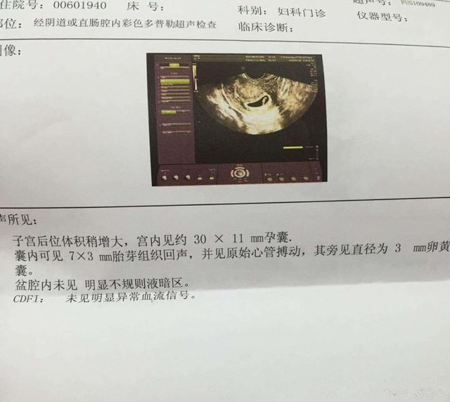 儿女双全, 二胎顺产男宝6斤7两, 男宝女宝症状分享