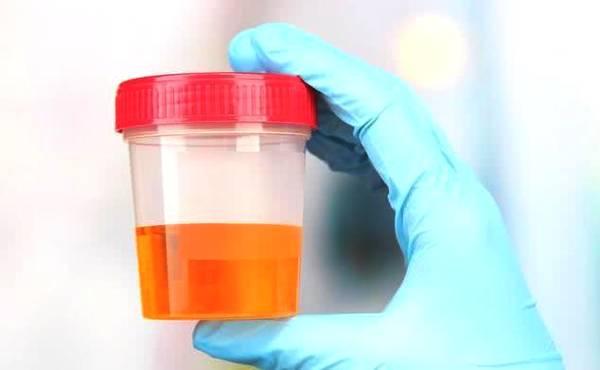 肝好不好早上起床就知道, 3种情况一出现是肝脏在求救