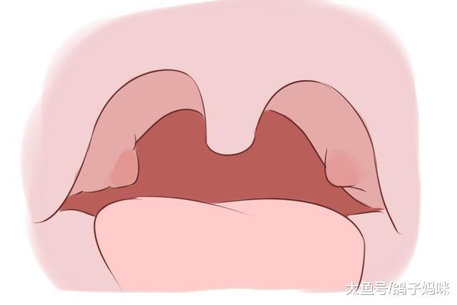 “猴儿包”说来就来, 怎样才能让孩子远离腮腺炎的侵袭?