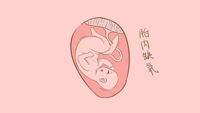 羊水或多或少都是危险信号, 这些问题要注意