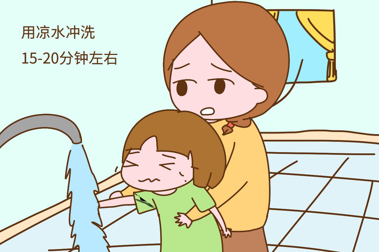 3岁儿子被烫伤, 妈妈做了一件事全家反对, 医生却给这位妈妈点赞