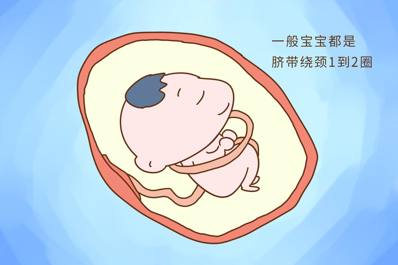 为何脐带绕颈两圈比一圈更危险? 医生给了正解, 孕妈要知道