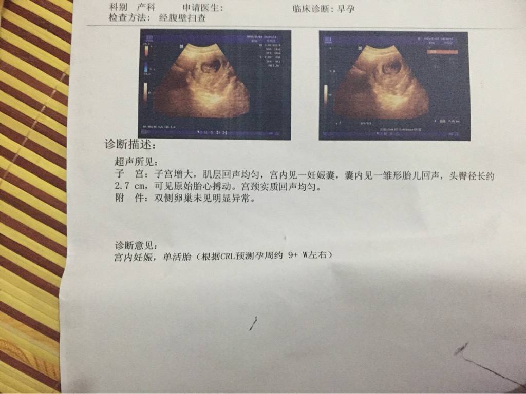 B超报告猜性别, 好奇的孕妈妈们试试吧