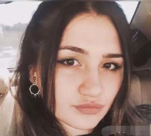 女子贪便宜, 低价请非专业人士帮忙整容, 结果整成了香肠嘴