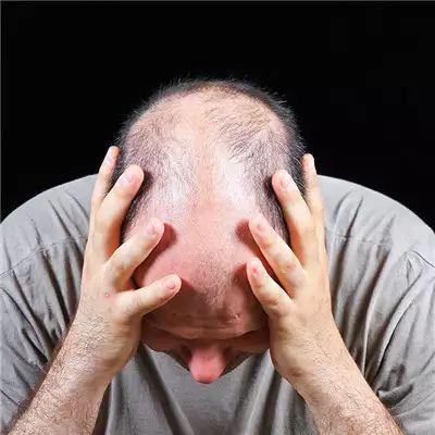 为什么早上起来, 感觉嘴里总有股苦味? 可能是这四个原因!