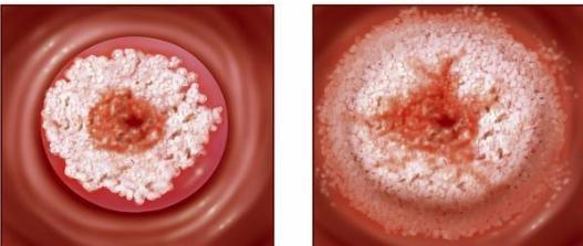 女孩腹痛难忍, 查出病因痛哭, 医生解释说: 经期的一个习惯害的!
