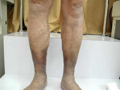 35岁男性睡前的一个习惯猝死, 医生: 几类人千万不能这么做