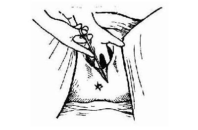 顺产也要挨一刀? 解读顺产侧切全过程!