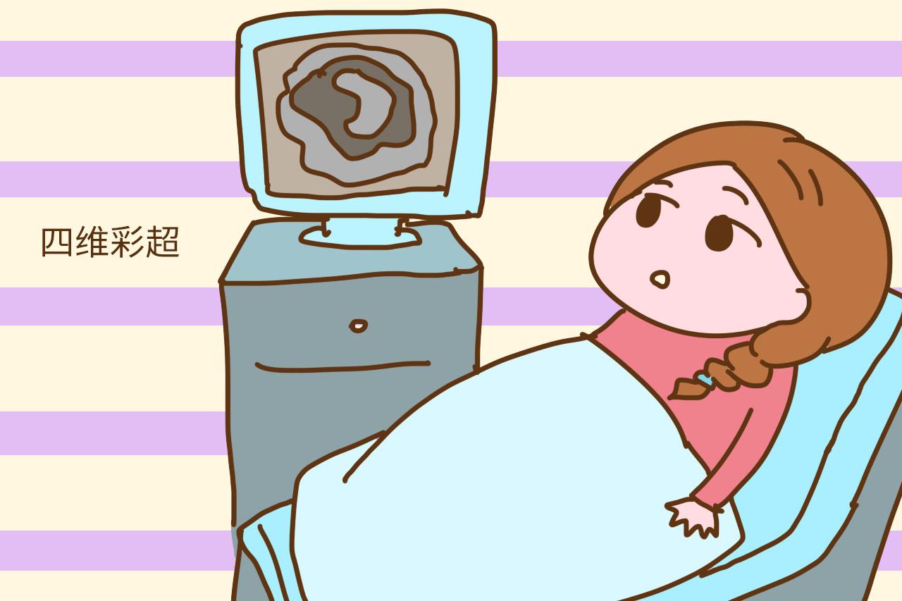 四维排畸并不是“全能”的, 这些胎儿畸形, 医生表示看不出来
