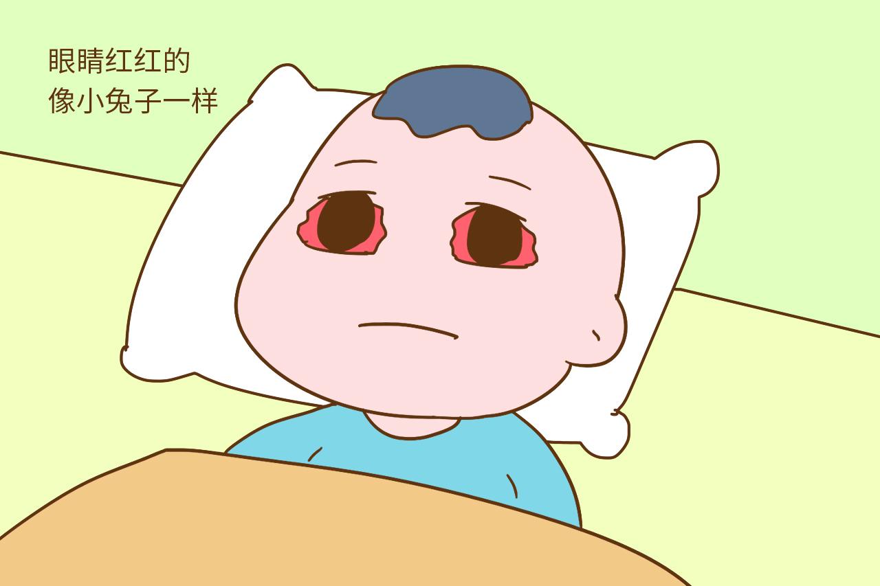 宝宝出现这4种情况, 说明过敏了, 快带娃就医别耽误