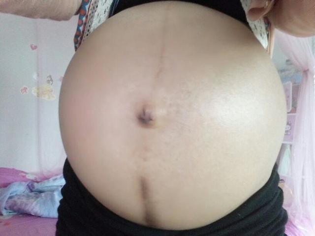 肚型看男女准吗? 我感觉还挺准吗, 分享孕期肚型及症状