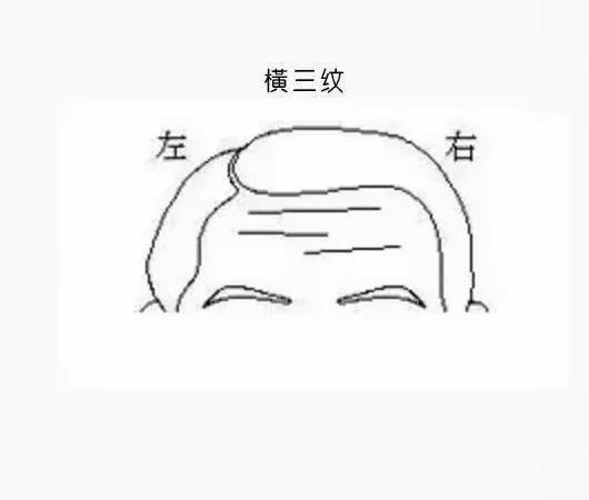 男克妻, 女克夫, 就因额头这道纹?