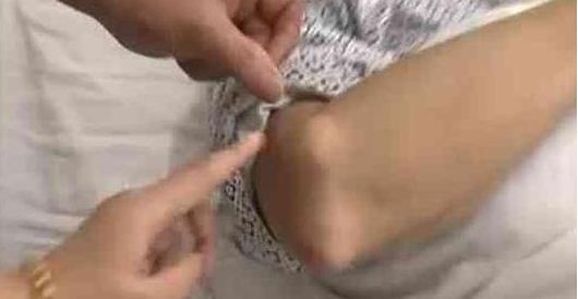 男子天天夜宵啤酒, 几天之后身上疯狂长石头, 原来是拿它下酒了!