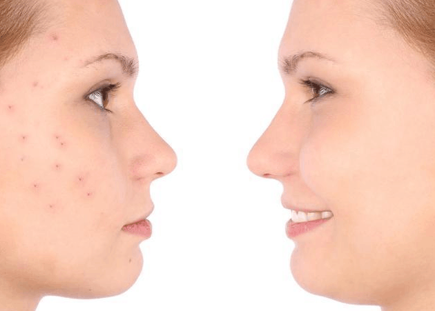 女人来“大姨妈”时, 如果没有3个“烦人”表现, 恭喜你, 子宫很温暖!