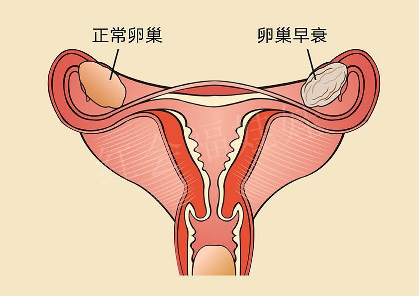 卵巢方面的疾病, 你知道多少呢?