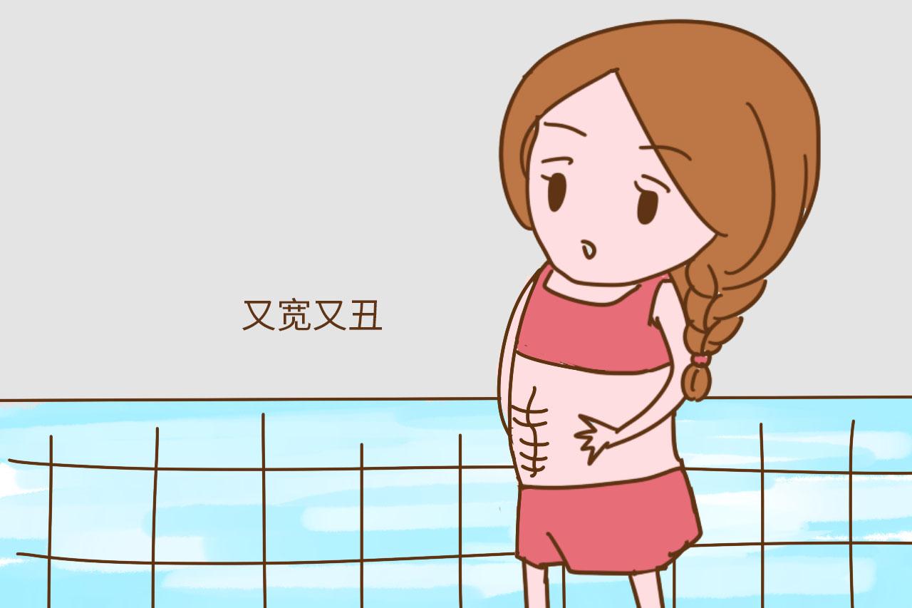 这2种体质的孕妈就别剖腹产了, 比顺产疼倒是其次, 关键还会变丑