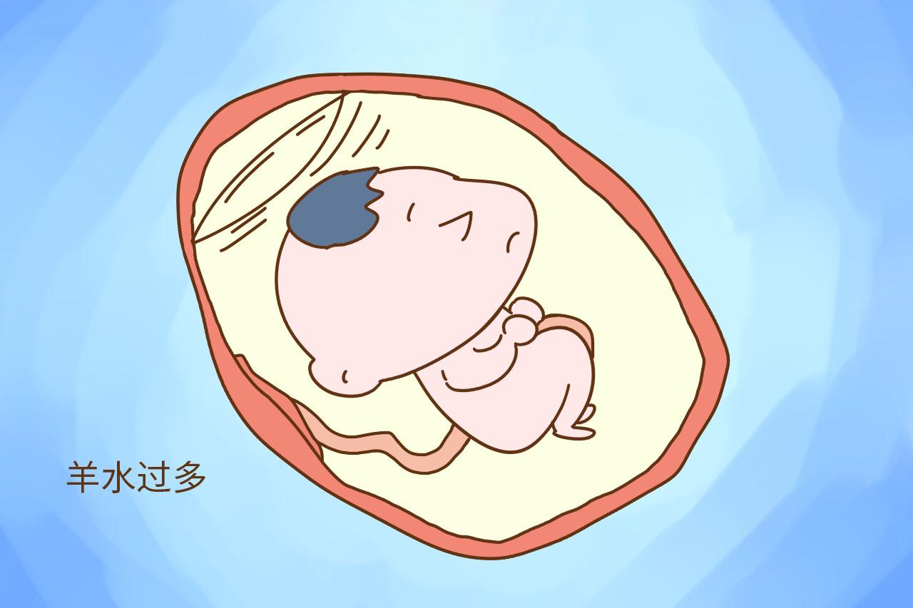这几种准妈妈, 宝宝可是会提前来, 不要傻傻等着预产期了