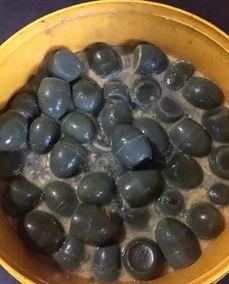 15岁男孩突发肾衰竭, 医生说: 跟他放学经常吃的一种食物有关!