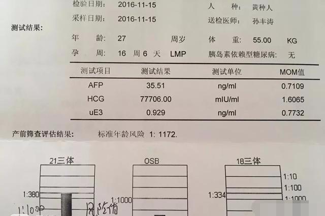 通过孕期肚型可以看男女, 看您能学会吗?