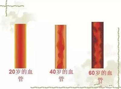 降压药有耐药性? 关于高血压真相, 许多人每天吃药却不知道!