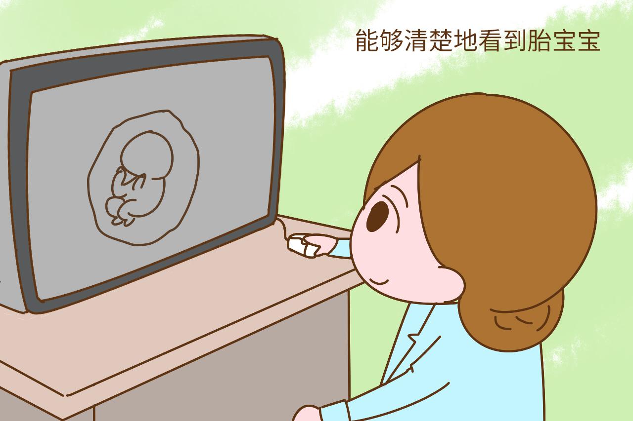 给胎宝宝拍四维彩超, 准爸妈遇见的搞笑事, 你遇见了吗?