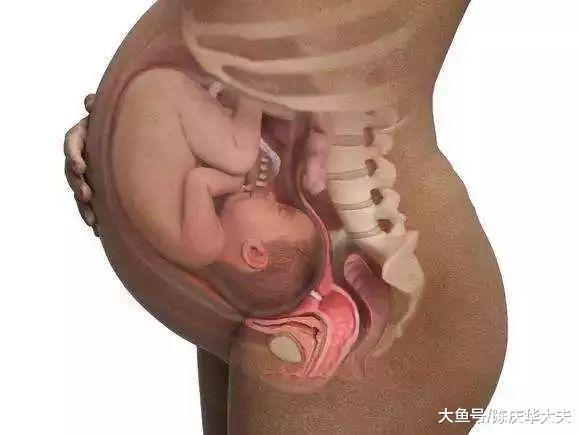 妊娠胎動